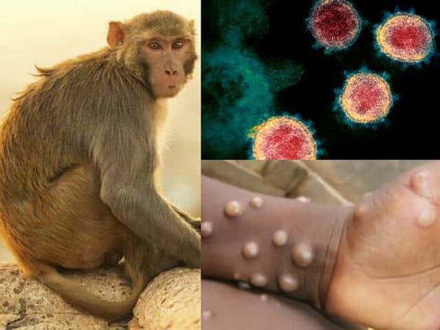 OMS: 780 de cazuri de variola maimuței confirmate în laboratoare